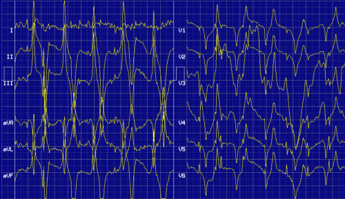 ecg in rust